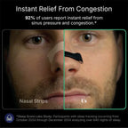 Sleepco Nasal Dilator Starter Kit. 4 Sizes. Improve airflow